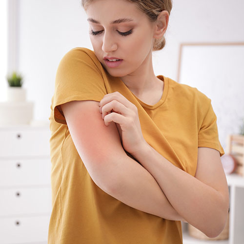 allergia-al-nichel-pruriti-cutanei_lofarma